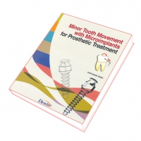 Book On Minor Tooth Movement with Microimplants for Prosthetic Treatment